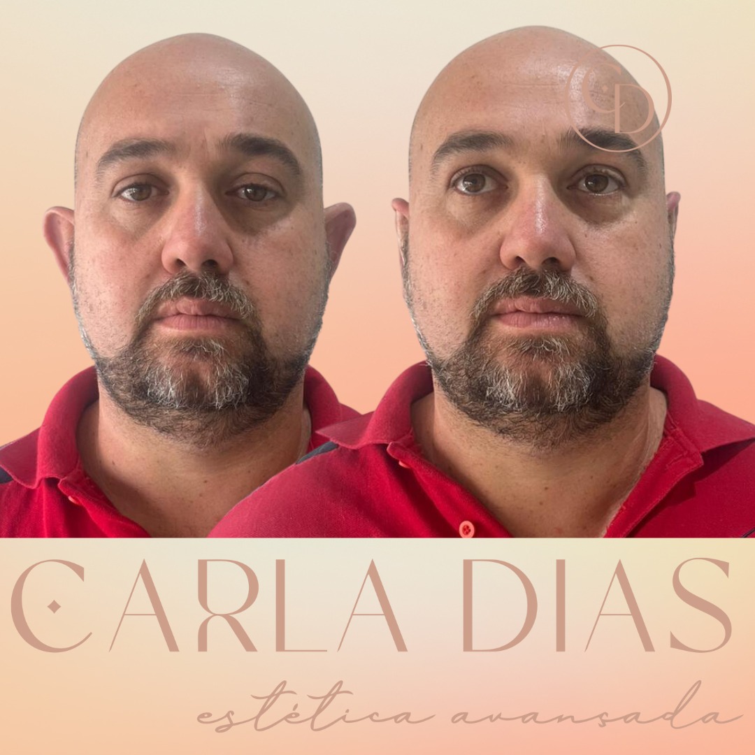 Resultado 1